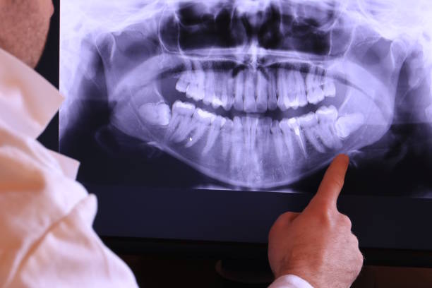 Best Holiday Emergency Dentist in Johnsburg, IL