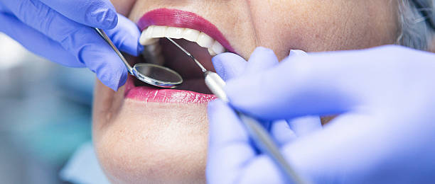 Best Broken or Cracked Tooth Emergency Dentist in Johnsburg, IL