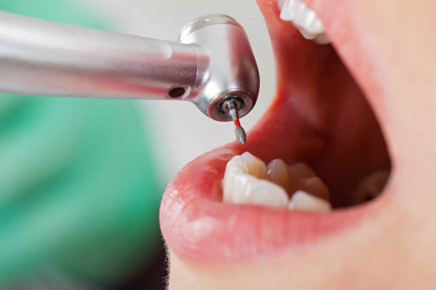 Best Emergency Dental Services for Seniors in Johnsburg, IL